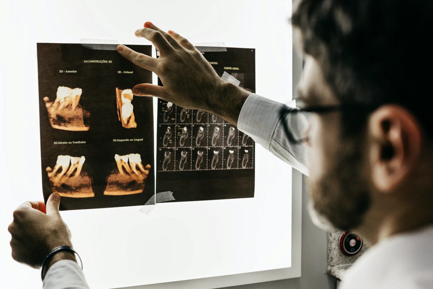 Dental Xrays