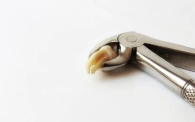 Same Day Tooth Extraction: Can You Get It?