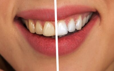 How much does cosmetic dentistry cost?