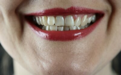Can Dentists See You Without Insurance?