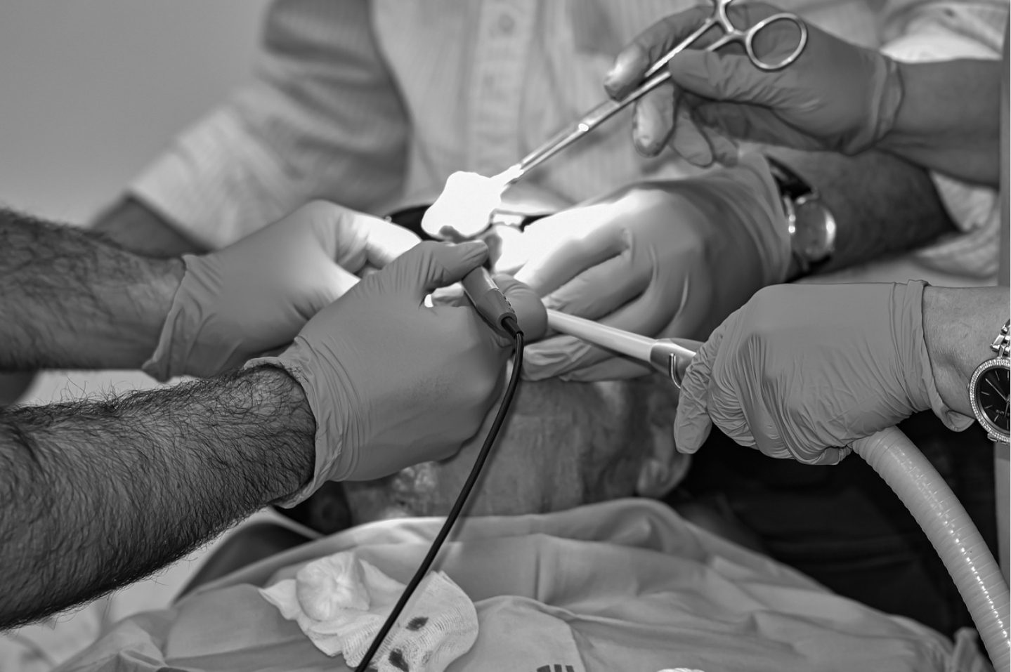 Dental Procedure Dental Procedure