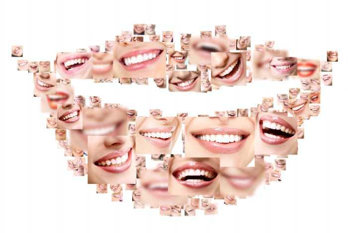 dental work
