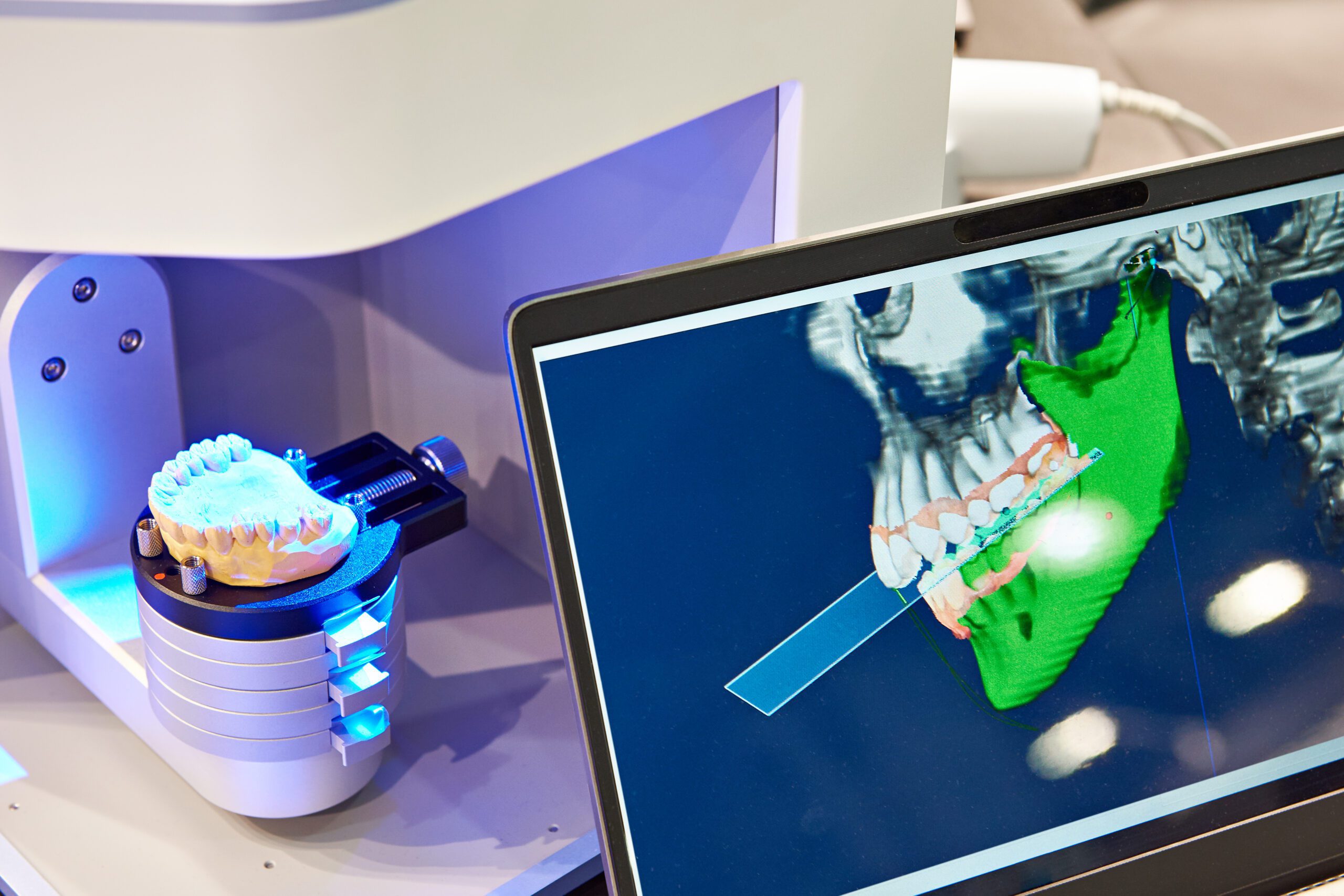 Dental Implant